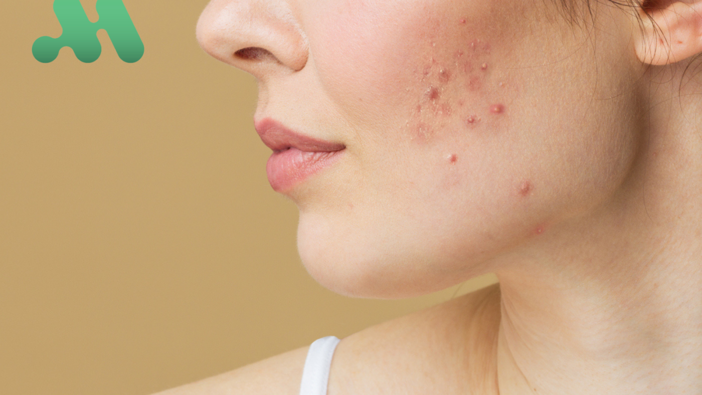 Untitled design (23)